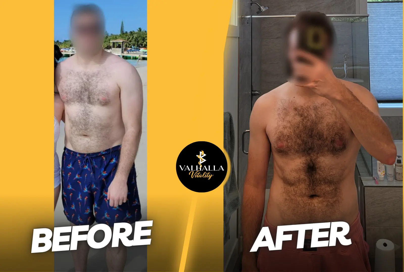 B&A 3