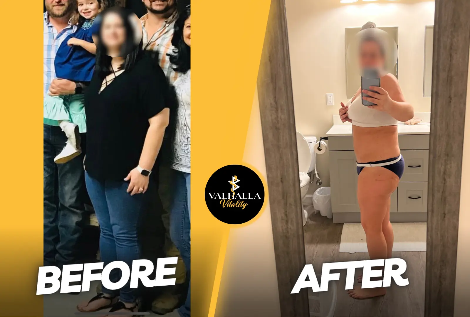 B&A 5